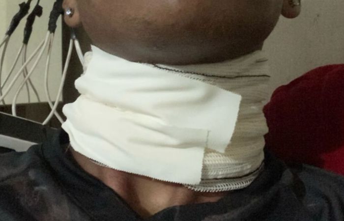 JANDAIA-Motociclista cai após se enroscar em cabo de internet solto