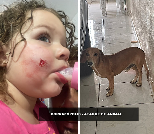 BORRAZÓPOLIS: Família busca identificar dono de cachorro que atacou criança